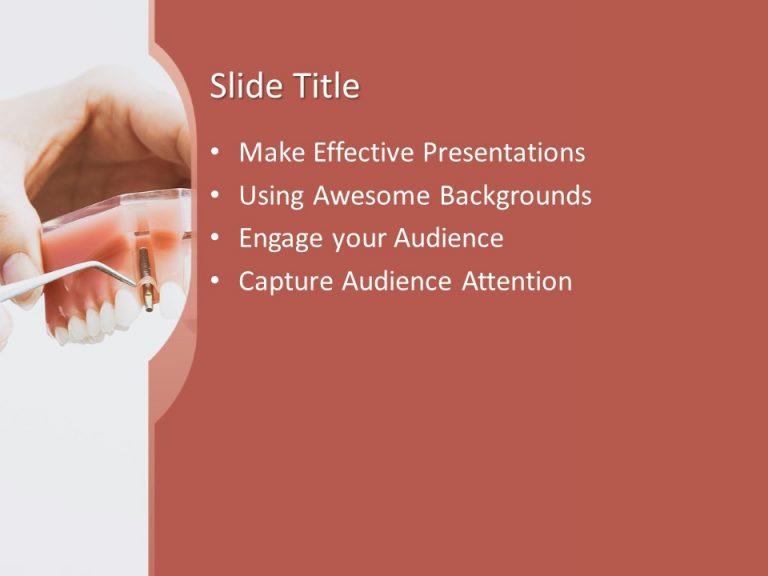 160649dentaltemplate4x33 Free PowerPoint Templates